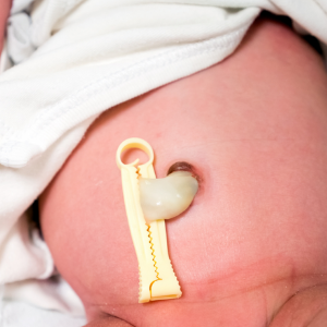 Read more about the article Umbilical Cord Care at Home: basics for the best start